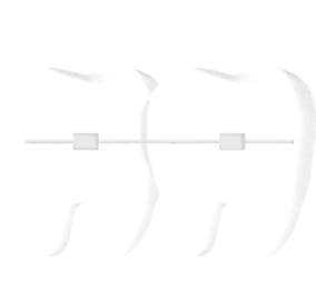 大人の矯正歯科